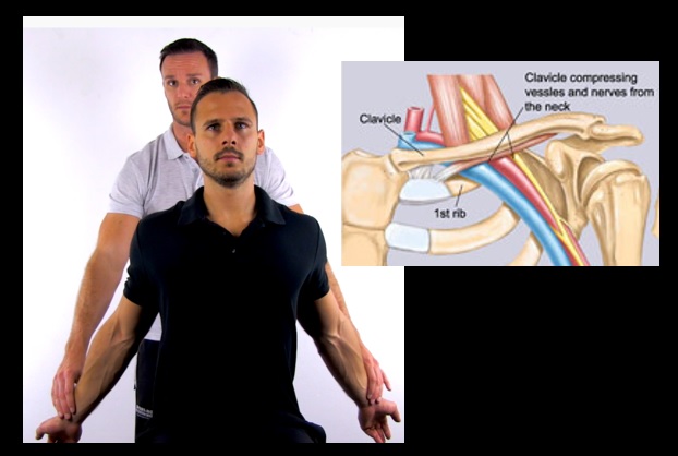 special tests for thoracic outlet syndrome